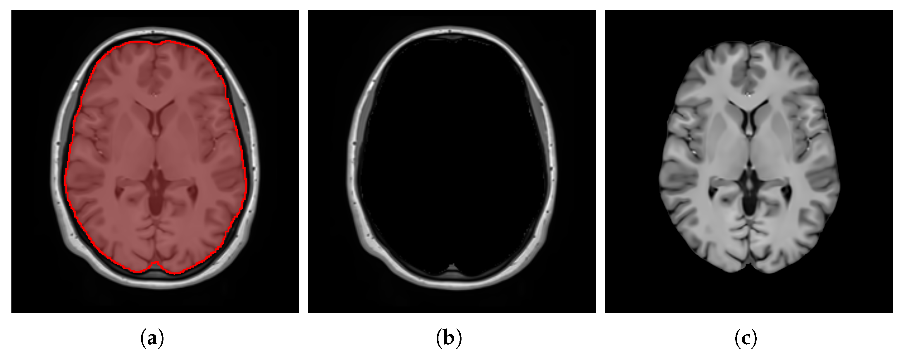 Bioengineering 12 00722 g007 Bioengineering 12 00722 g007