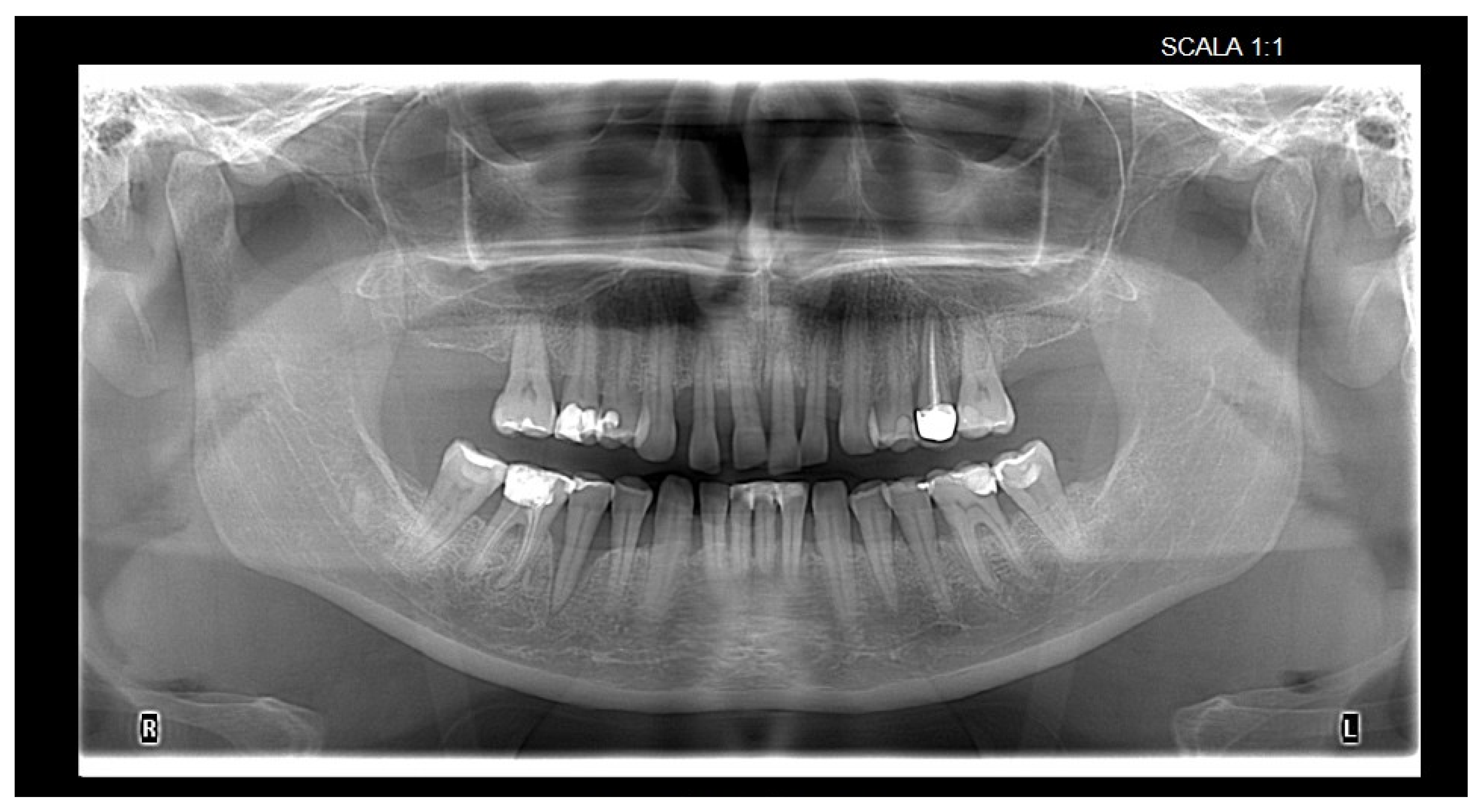 Bioengineering 12 00766 g006