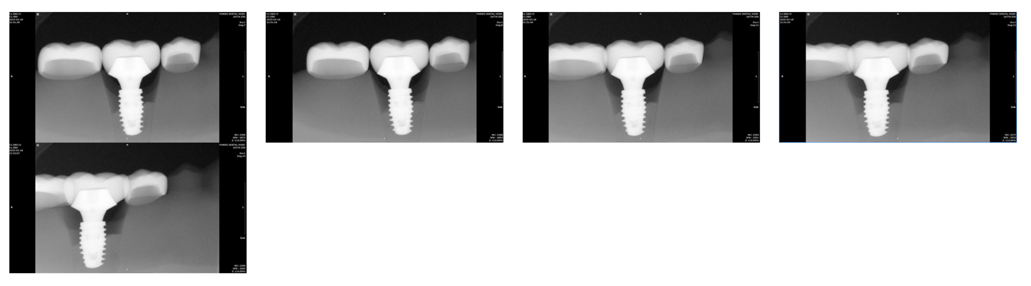 Bioengineering 12 00772 g005