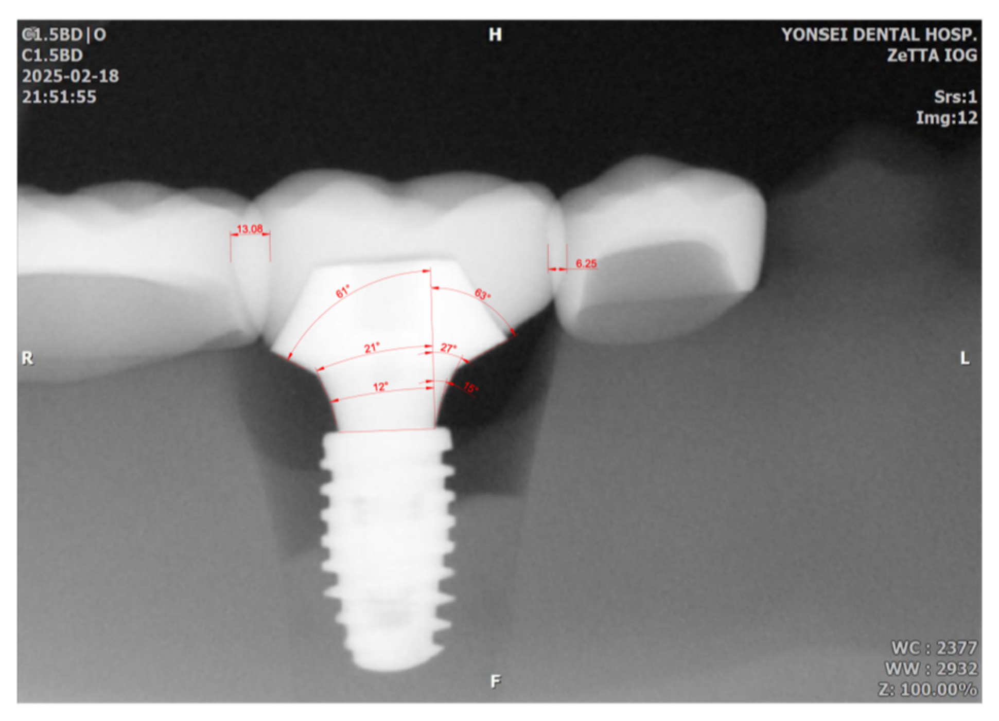 Bioengineering 12 00772 g006