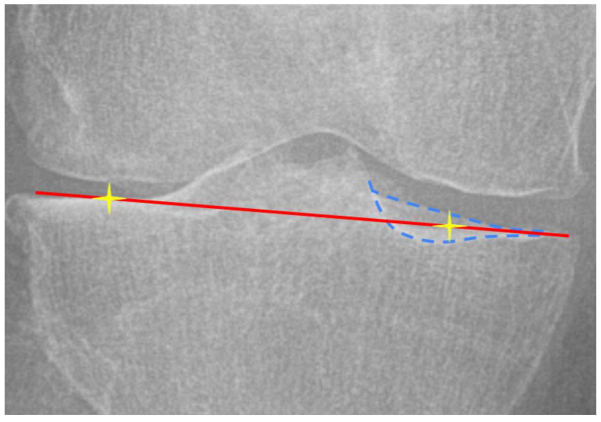 Bioengineering 12 00794 g003