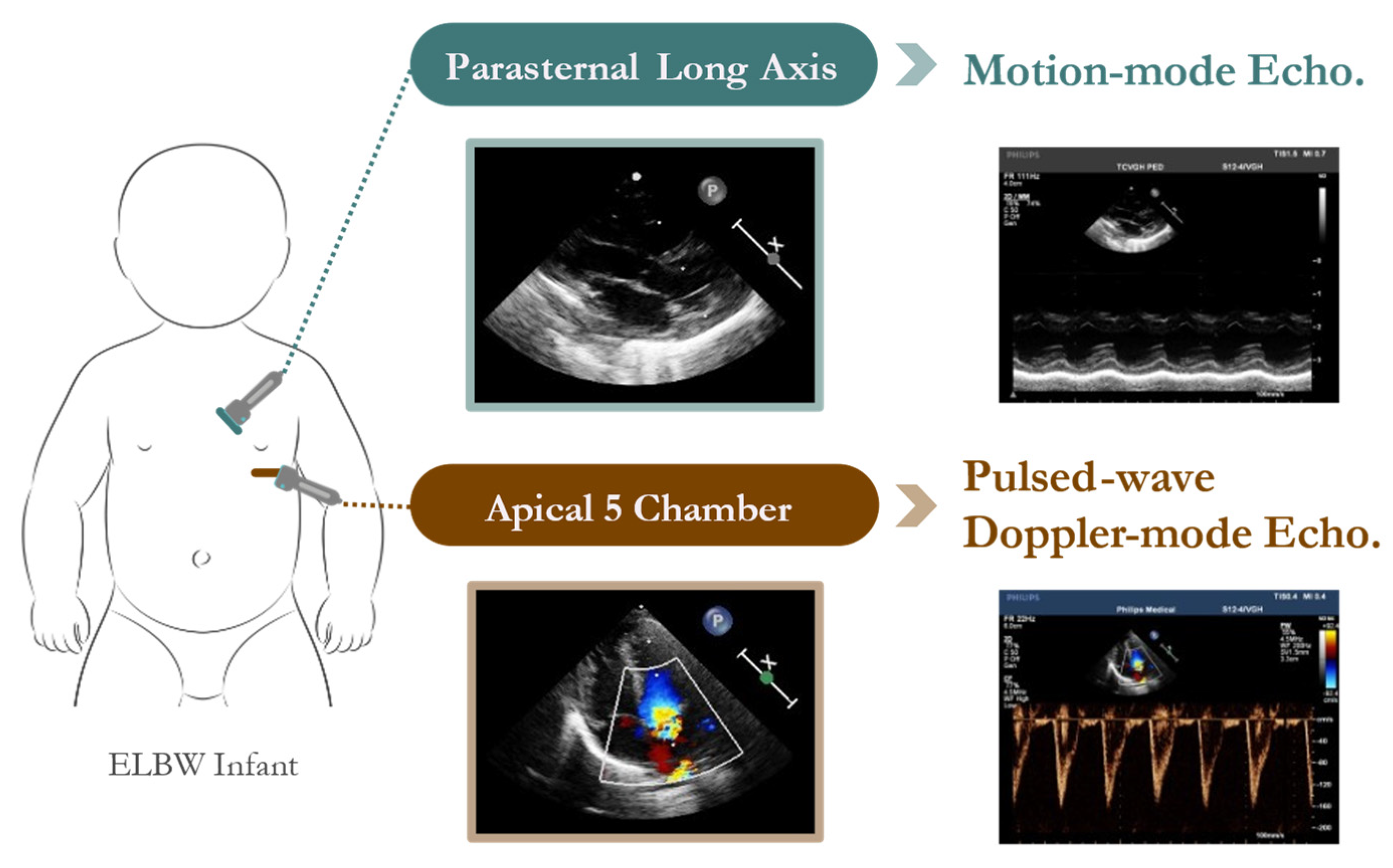 Bioengineering 12 00815 g002