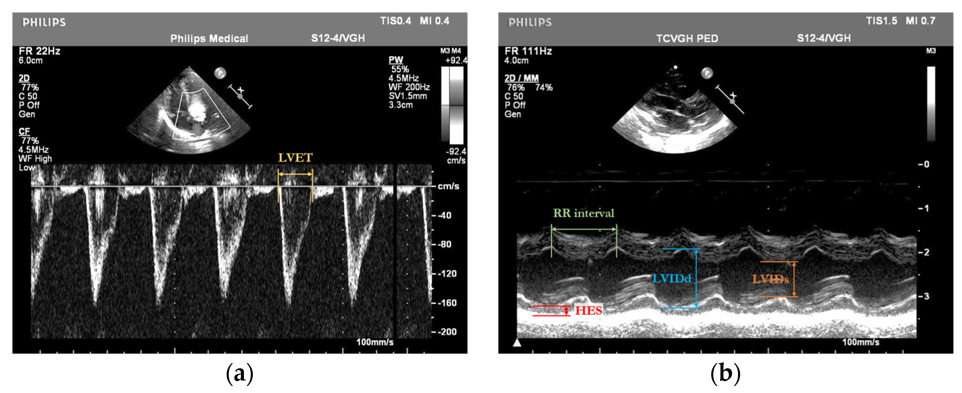 Bioengineering 12 00815 g003