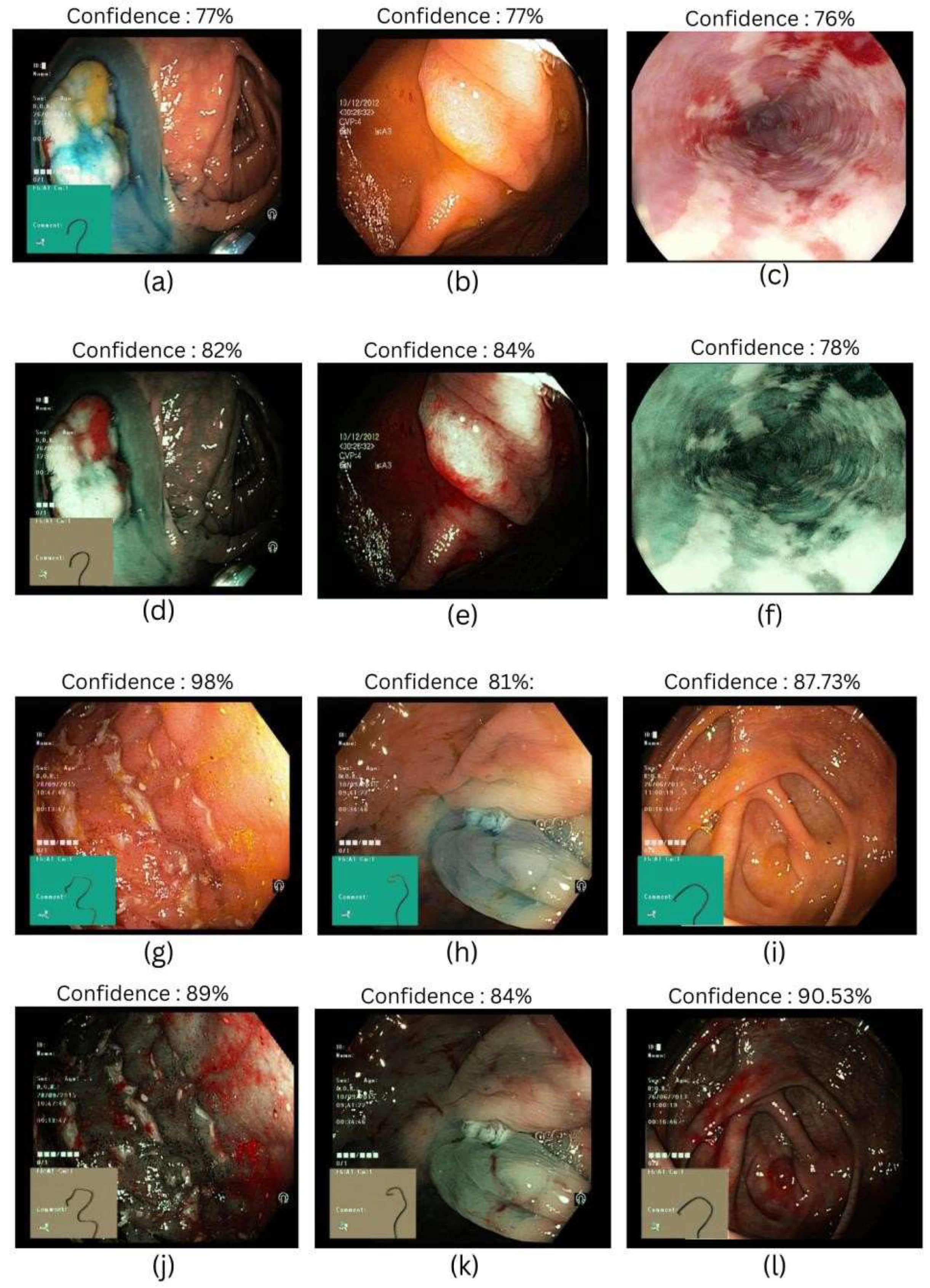 Bioengineering 12 00828 g002