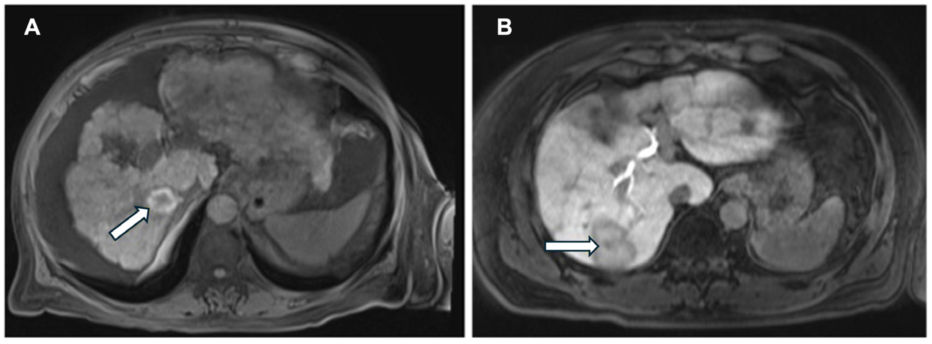 Bioengineering 12 00870 g006