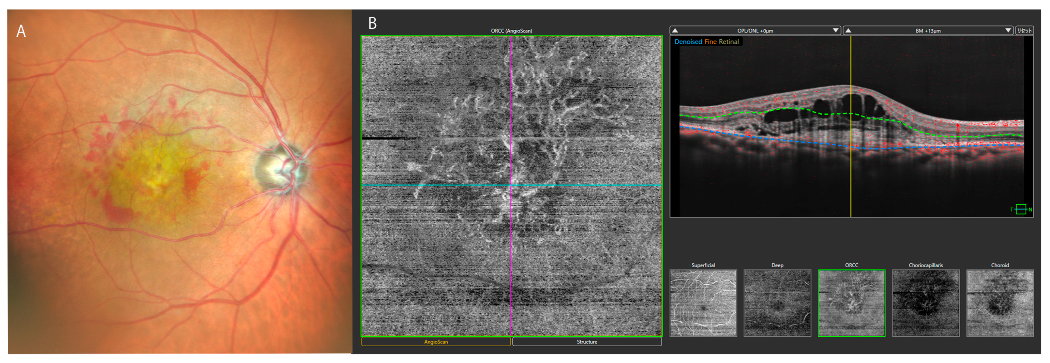 Bioengineering 12 00962 g002 Bioengineering 12 00962 g002
