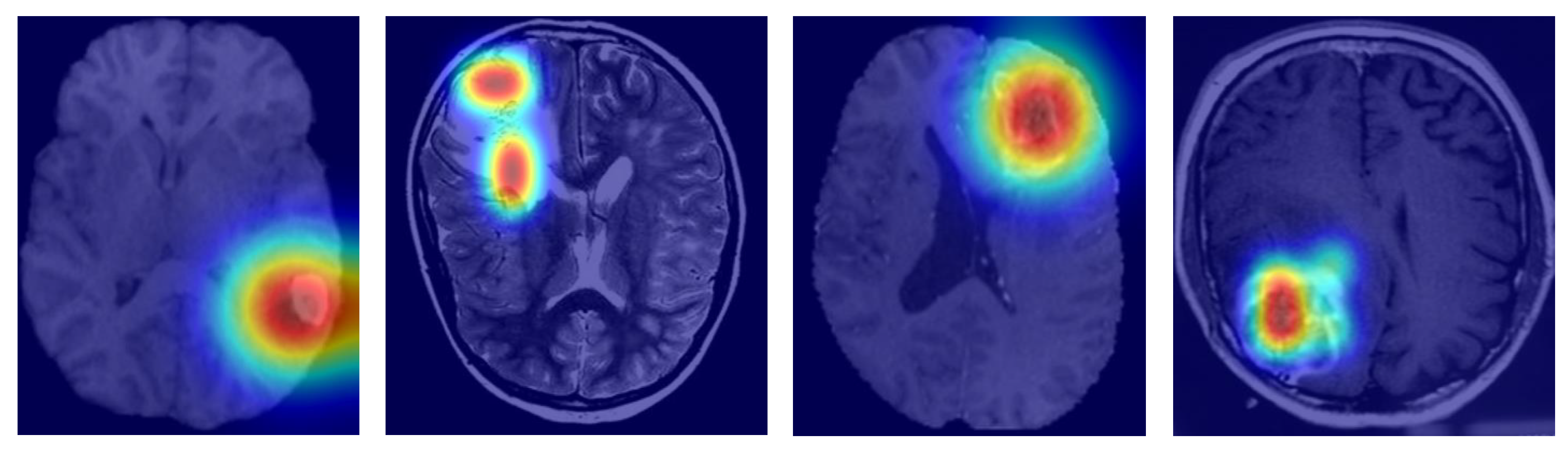 Bioengineering 12 00979 g006