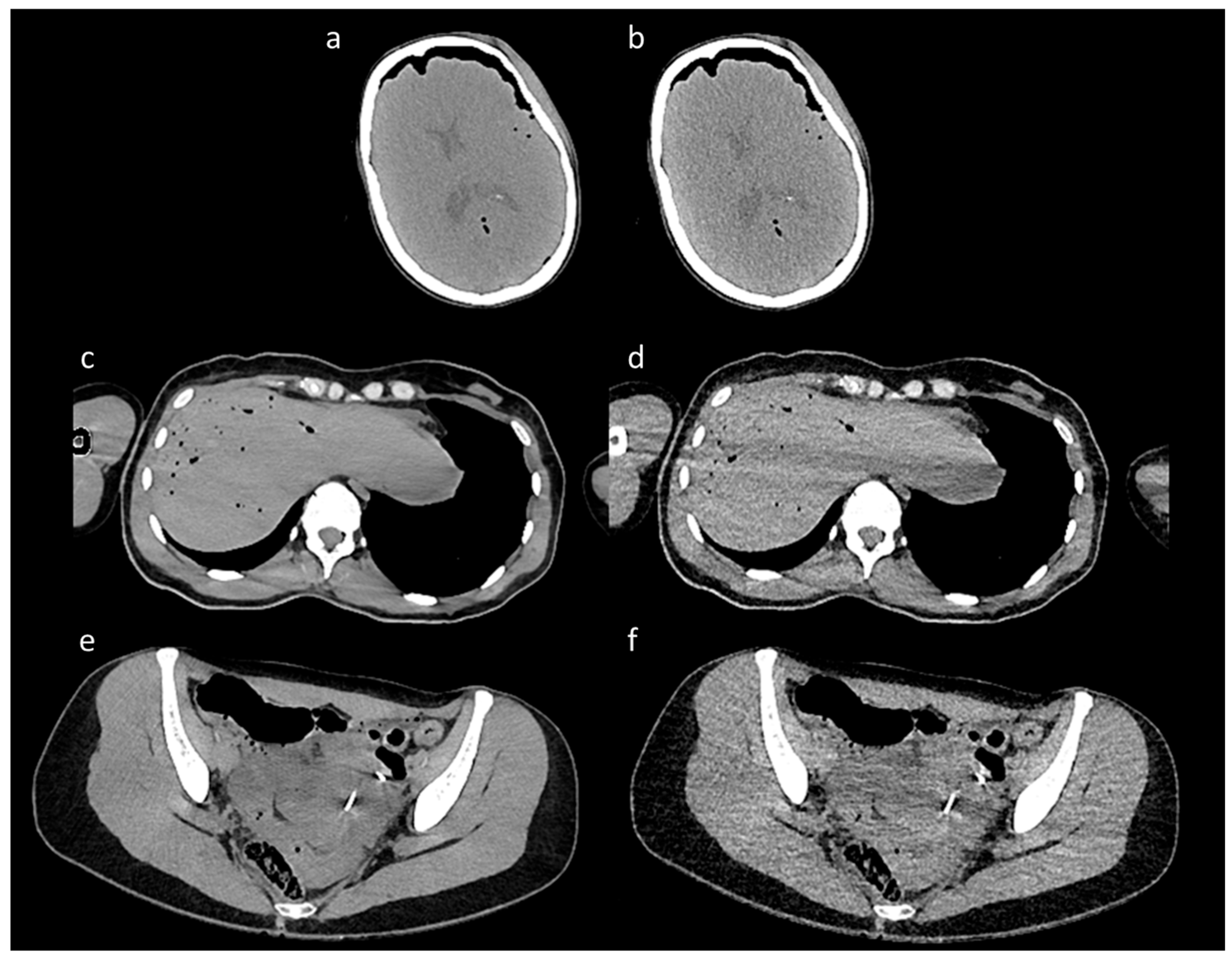 Bioengineering 12 00997 g001