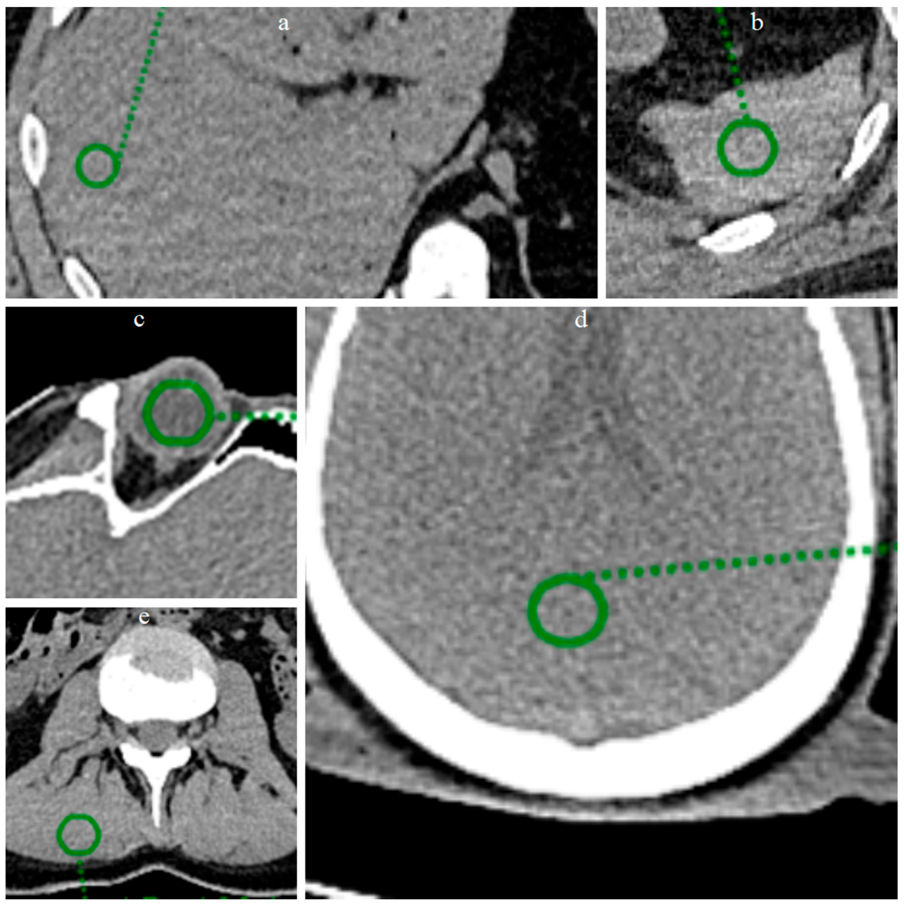 Bioengineering 12 00997 g003