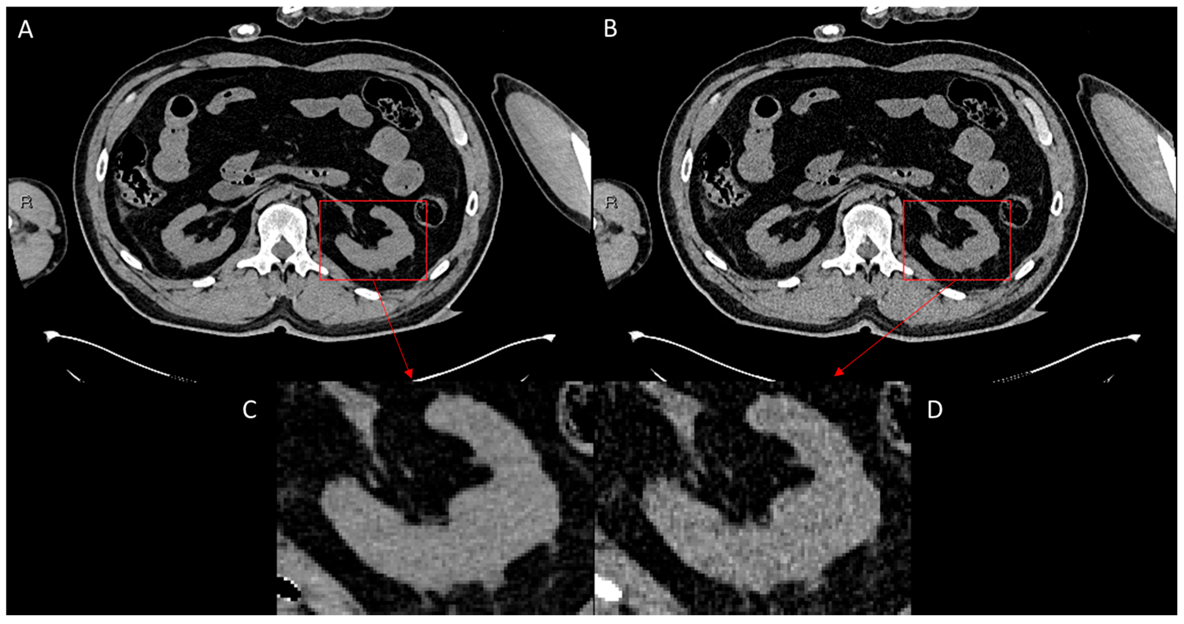 Bioengineering 12 00997 g004