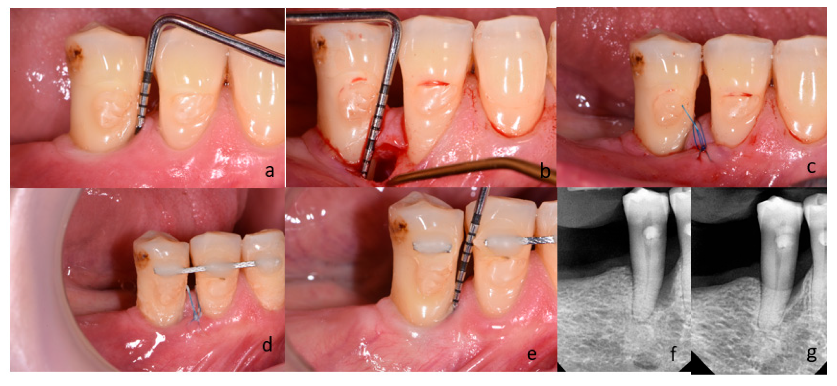 Bioengineering 12 01002 g003