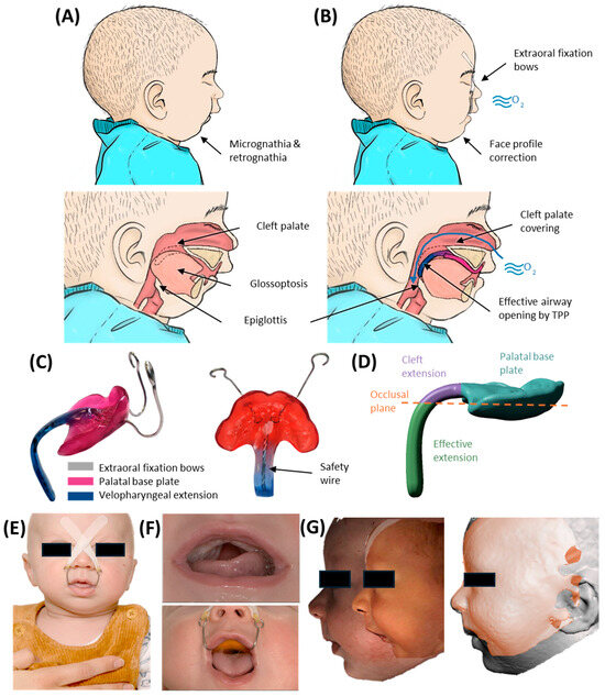 Complete Protocol and Guidelines for the Implementation and