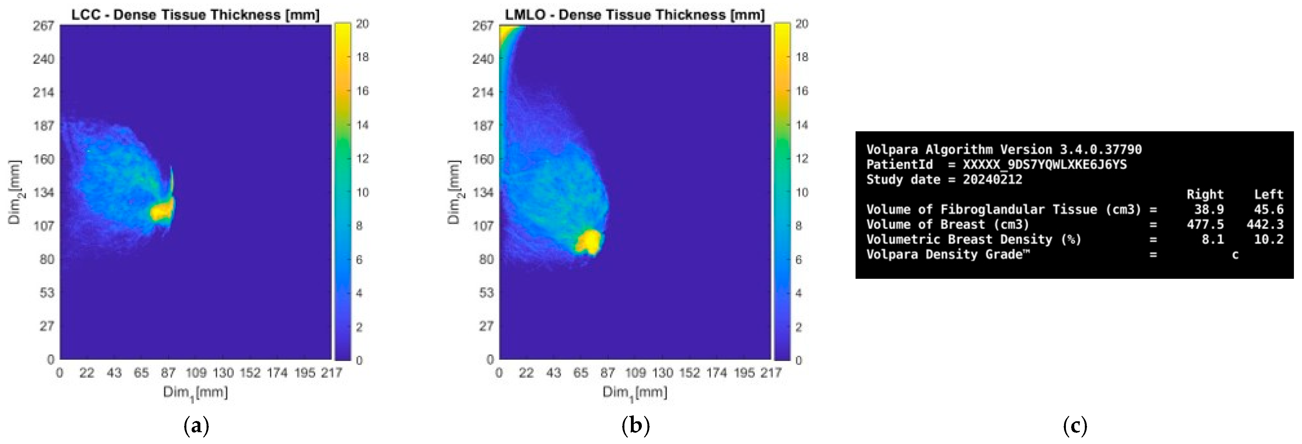 Bioengineering 12 01079 g012 Bioengineering 12 01079 g012