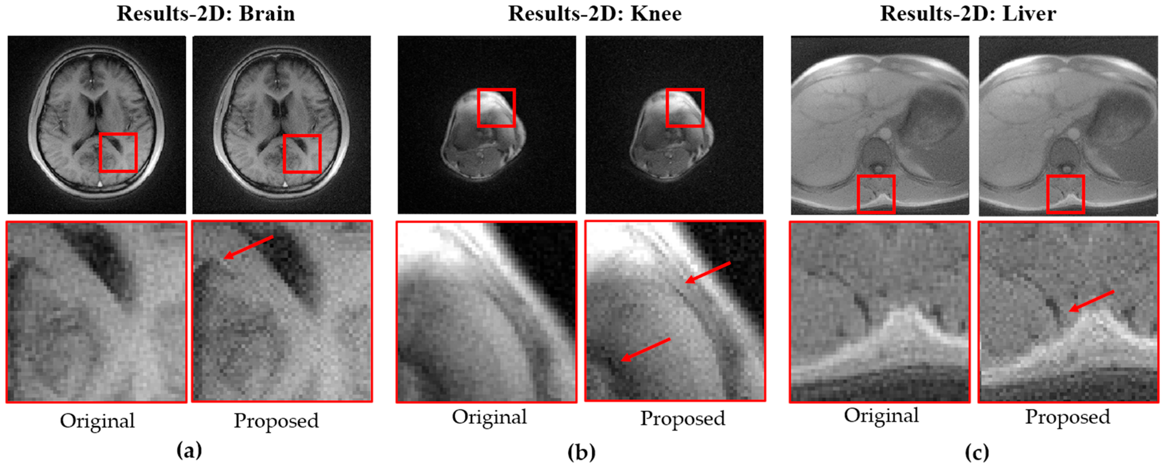 Bioengineering 12 01152 g007