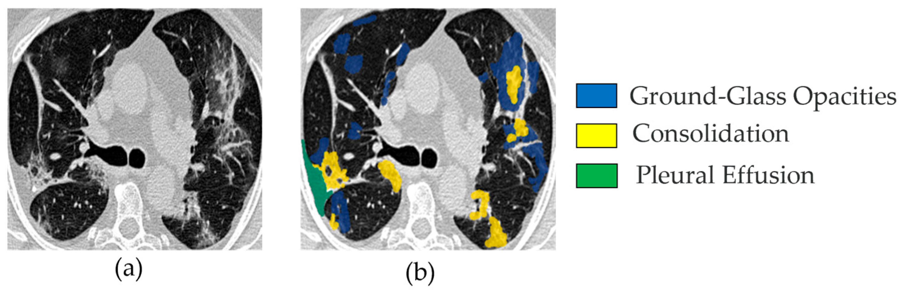 Bioengineering 12 01227 g001