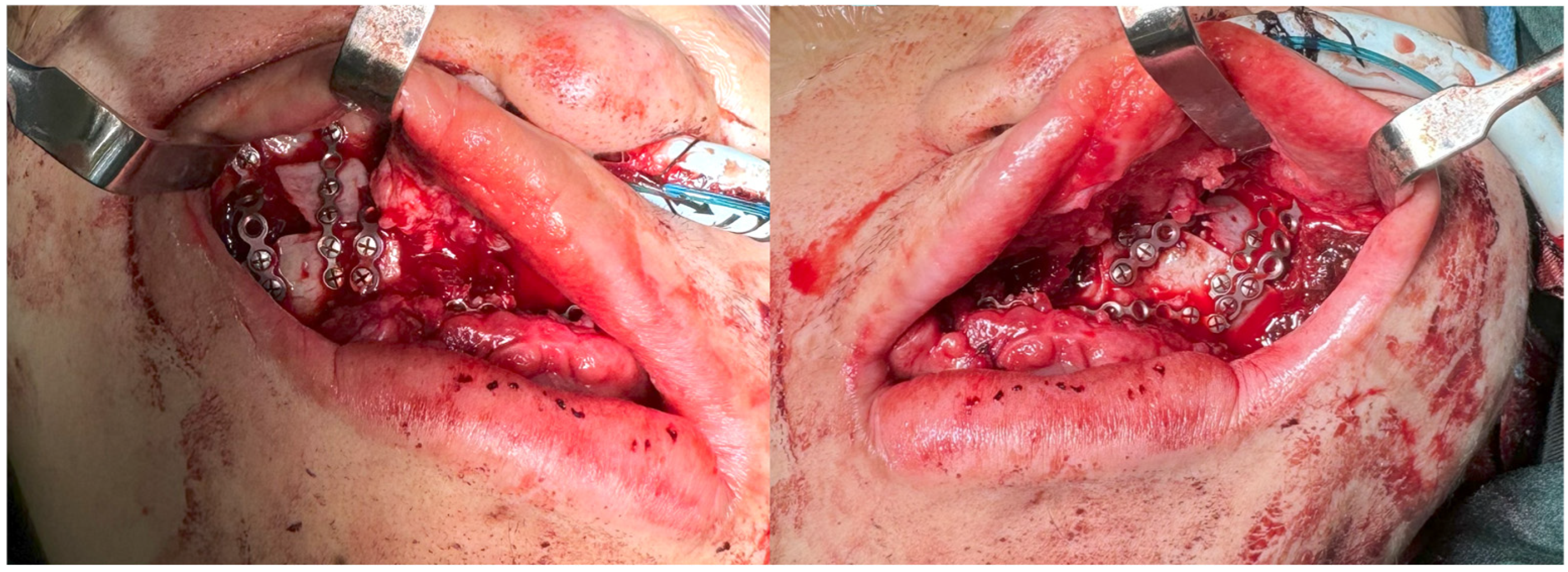 Bioengineering 13 00010 g009