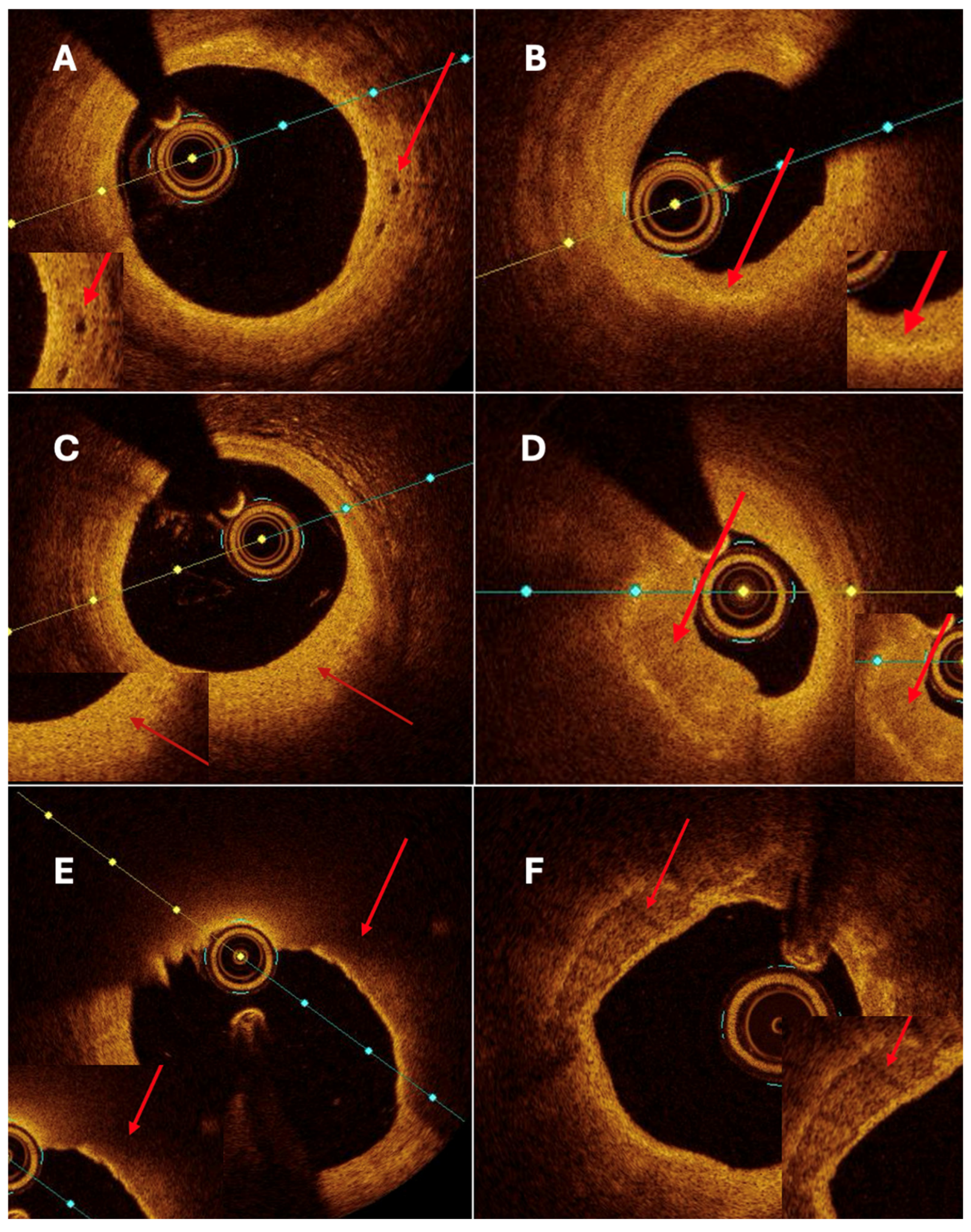 Bioengineering 13 00014 g004