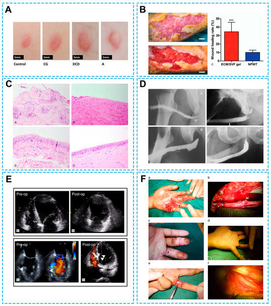 From Production to the Clinic: Decellularized Extracellular Matrix