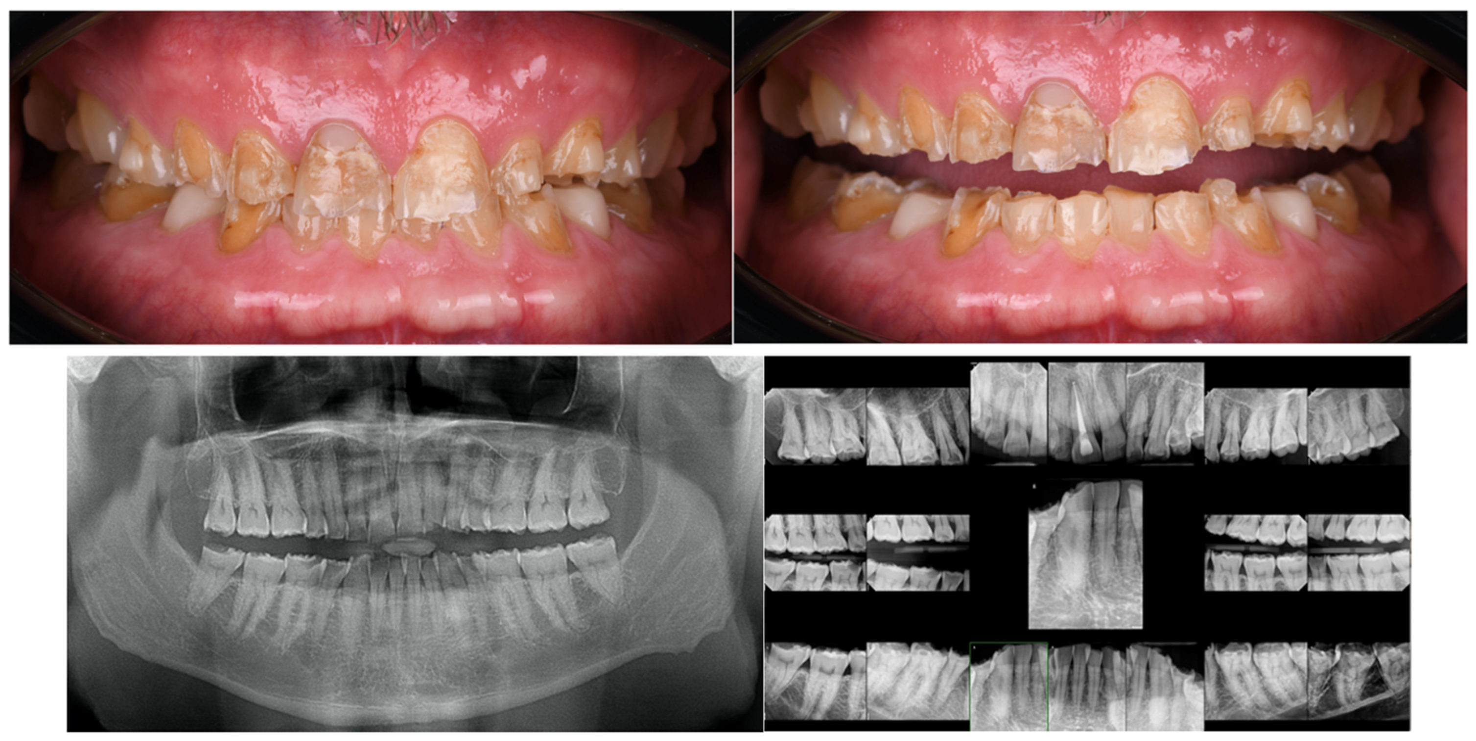 Bioengineering 13 00077 g001 Bioengineering 13 00077 g001