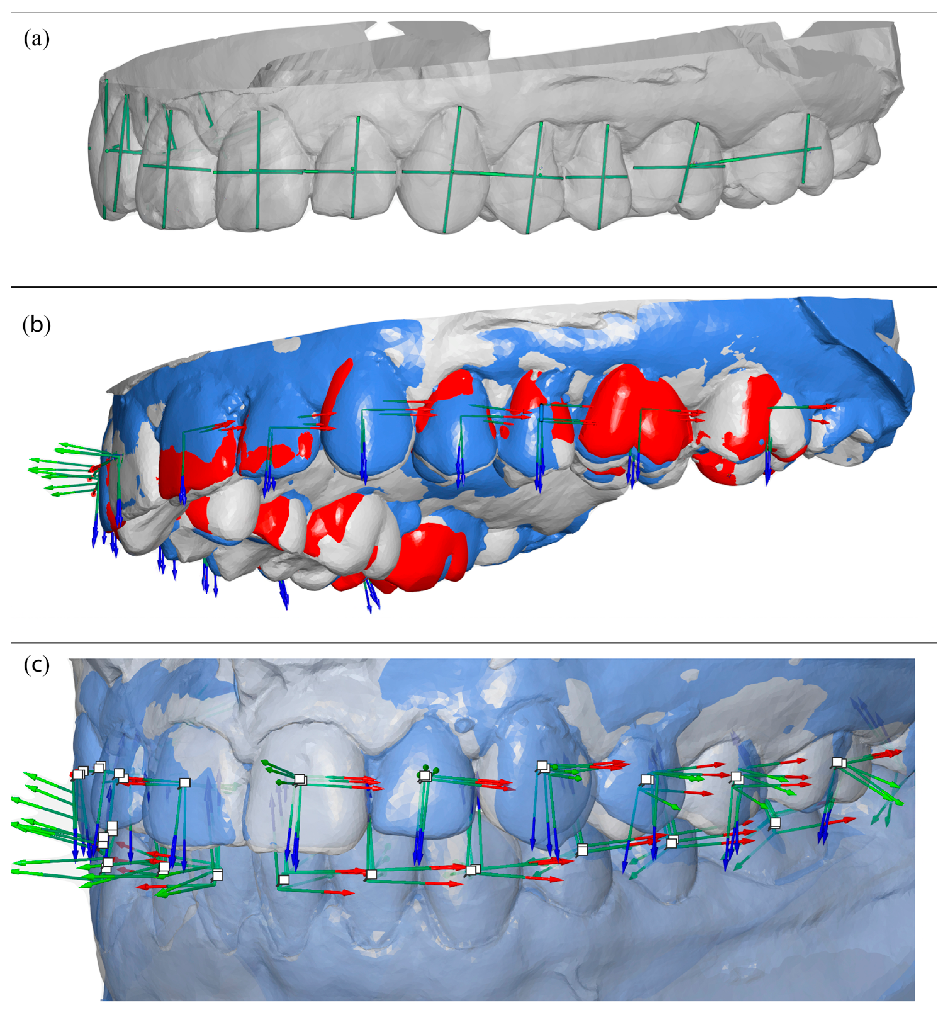 Three-Dimensional Accuracy of Digitally Planned Orthodontic Tooth
