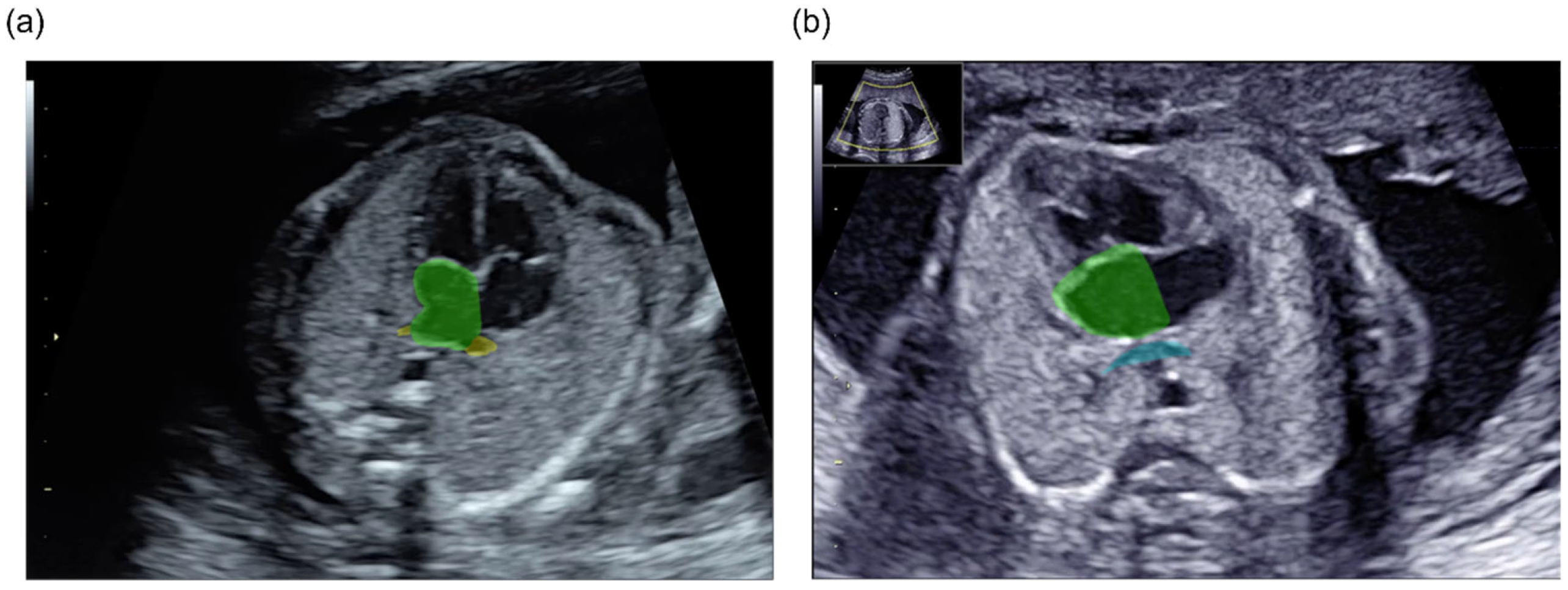 Bioengineering 13 00100 g001