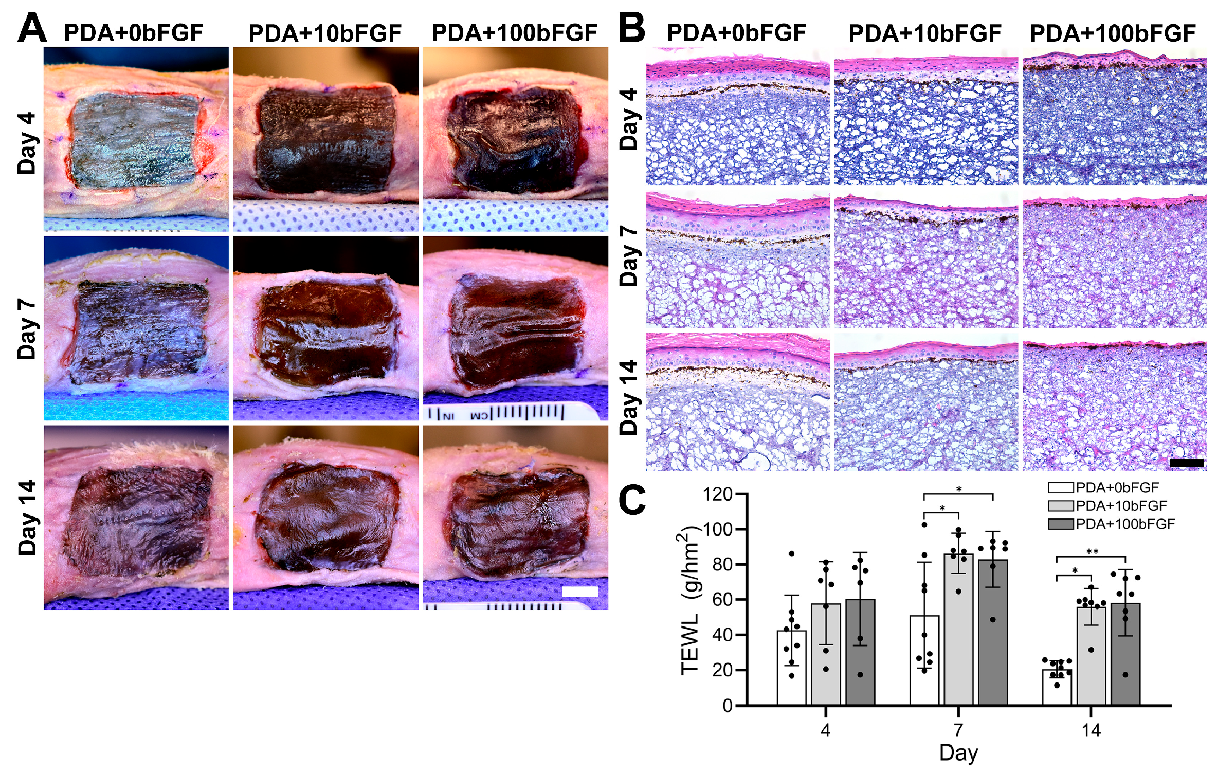 bFGF-Loaded PDA Microparticles Enhance Vascularization of