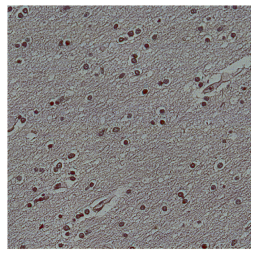 Bioengineering 13 00306 i021