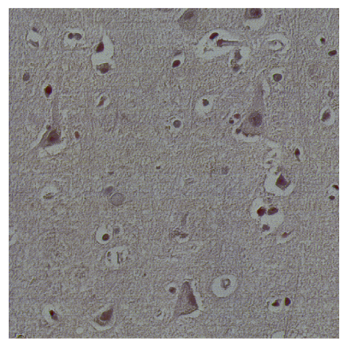 Bioengineering 13 00306 i026