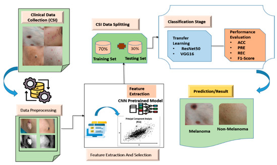 Deep Learning-Assisted Early Detection of Skin Cancer from Dermoscopic ...