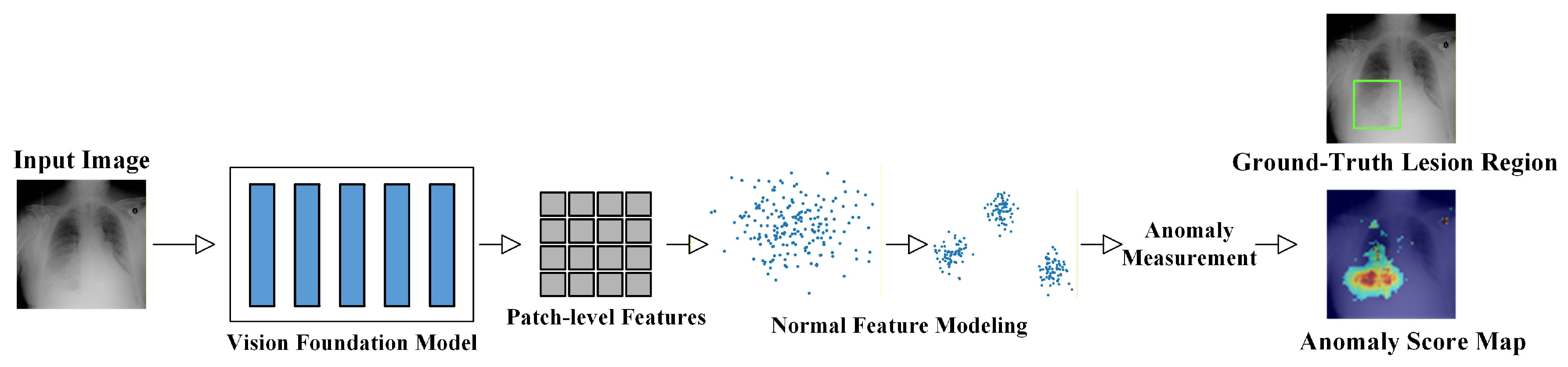 Unsupervised Anomaly Detection in Medical Imaging: A Survey of Methods ...