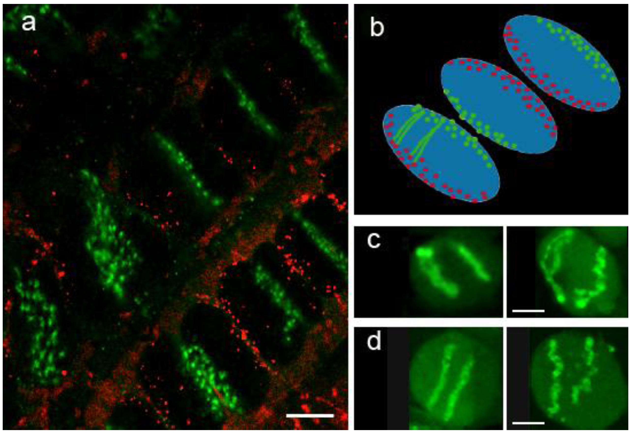 chromatin negative nuclei