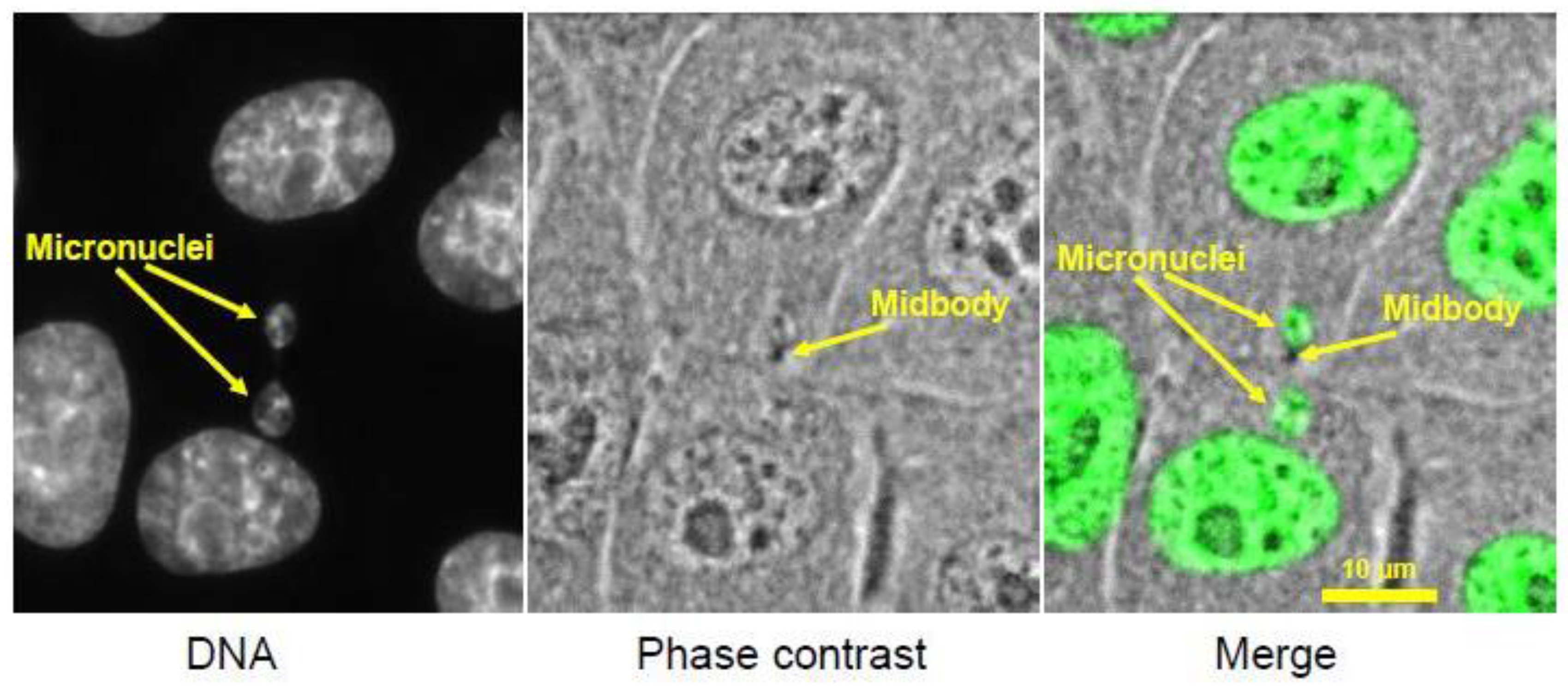The Consequences of Chromosome Segregation ... Biology Diagrams