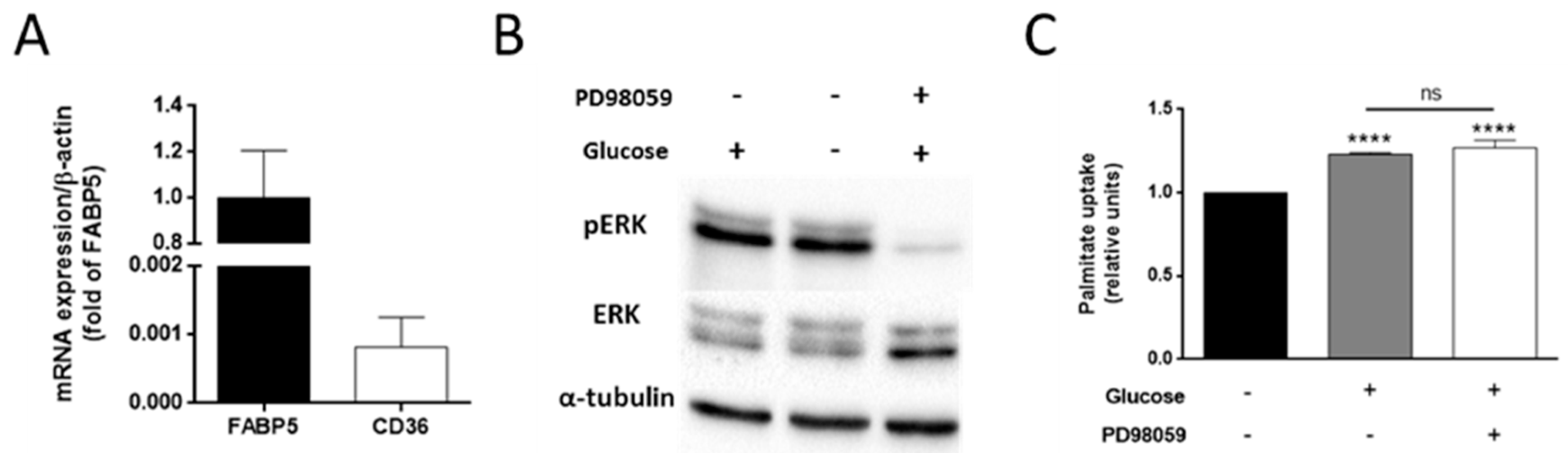 Glucose Favors Lipid Anabolic Metabolism in the Invasive Glucose Favors Lipid Anabolic Metabolism in the Invasive