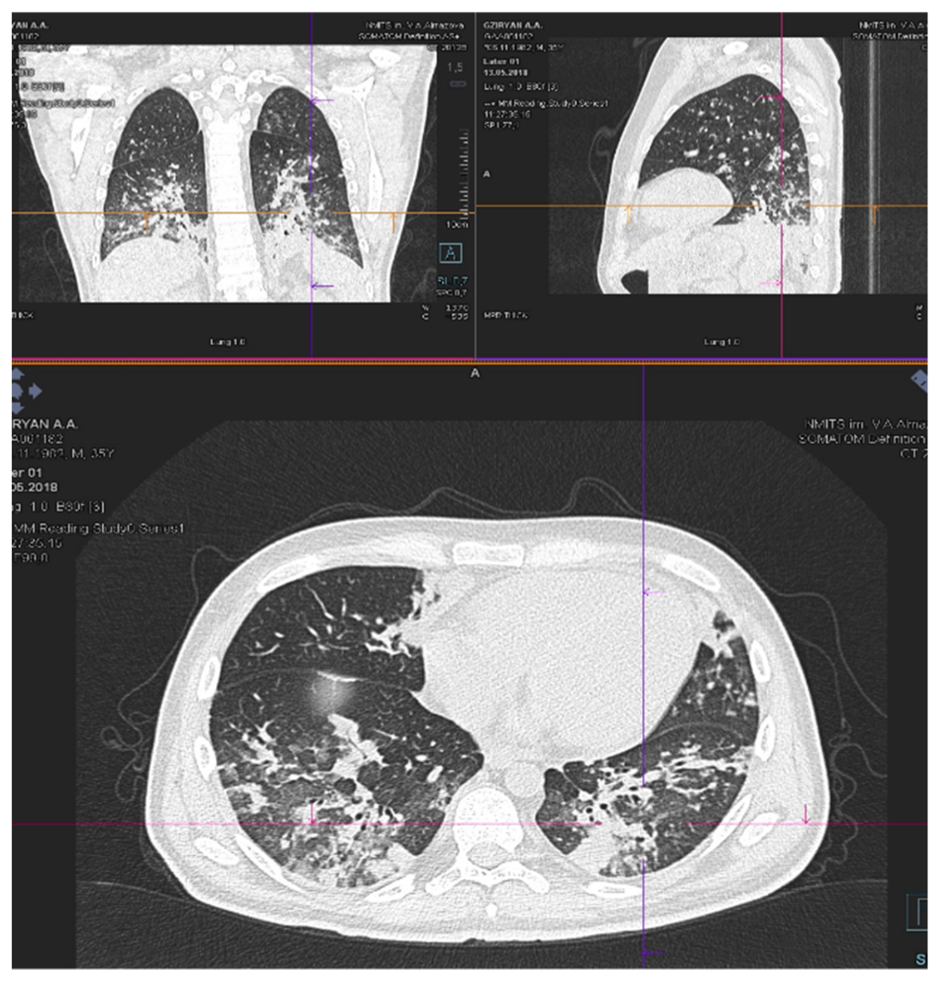 獣医腫瘍外科Surgical Oncology 獣医腫瘍外科Surgical Oncology 本