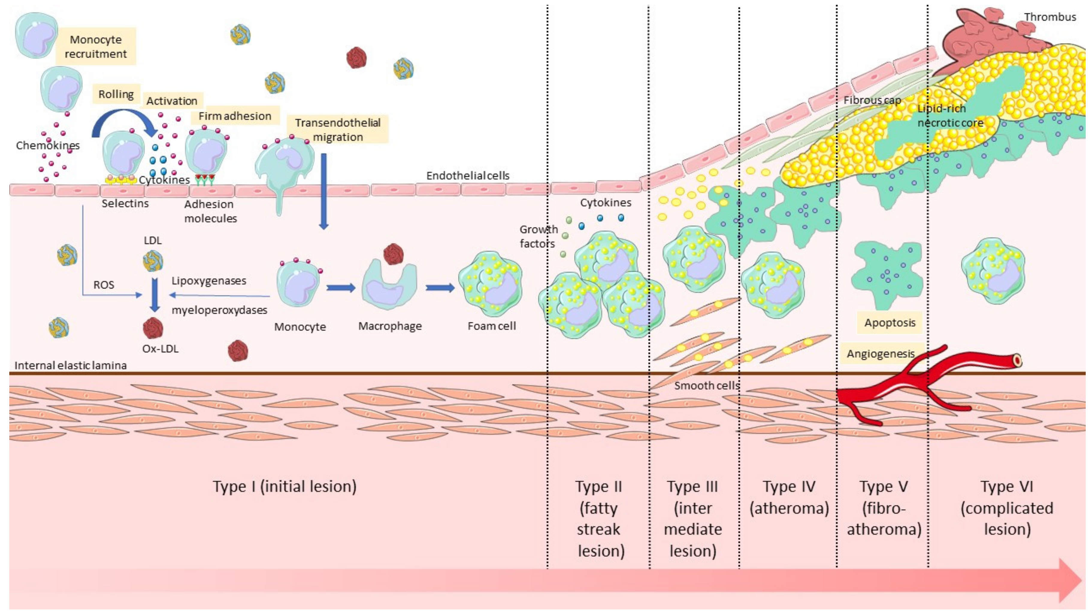 Biology | Free Full-Text | Vcam-1 Target In Non-Invasive Imaging For The Detection Of Atherosclerotic Plaques