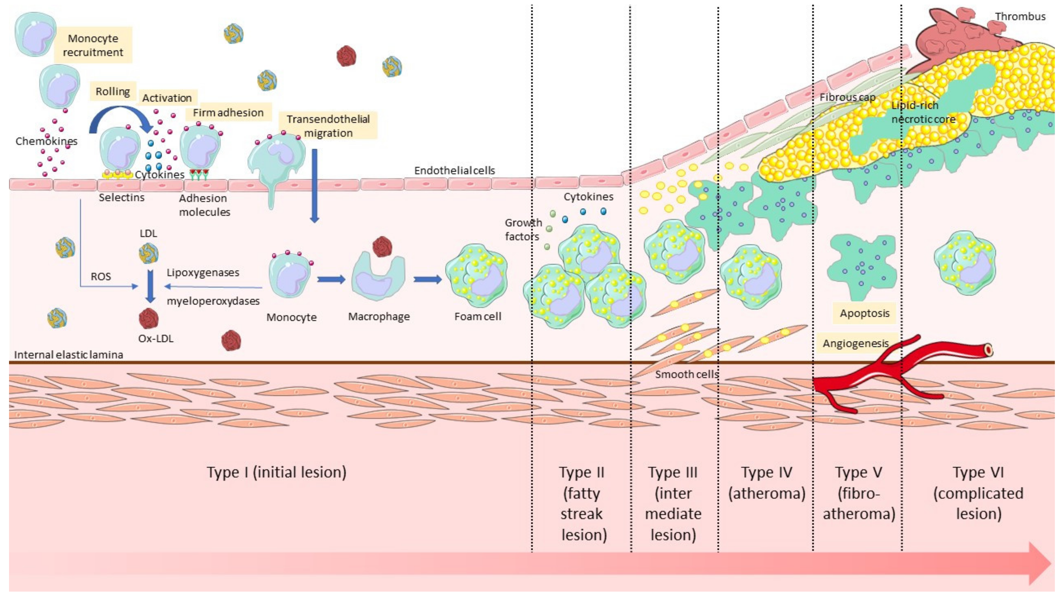 Biology | Free Full-Text | Vcam-1 Target In Non-Invasive Imaging For The  Detection Of Atherosclerotic Plaques