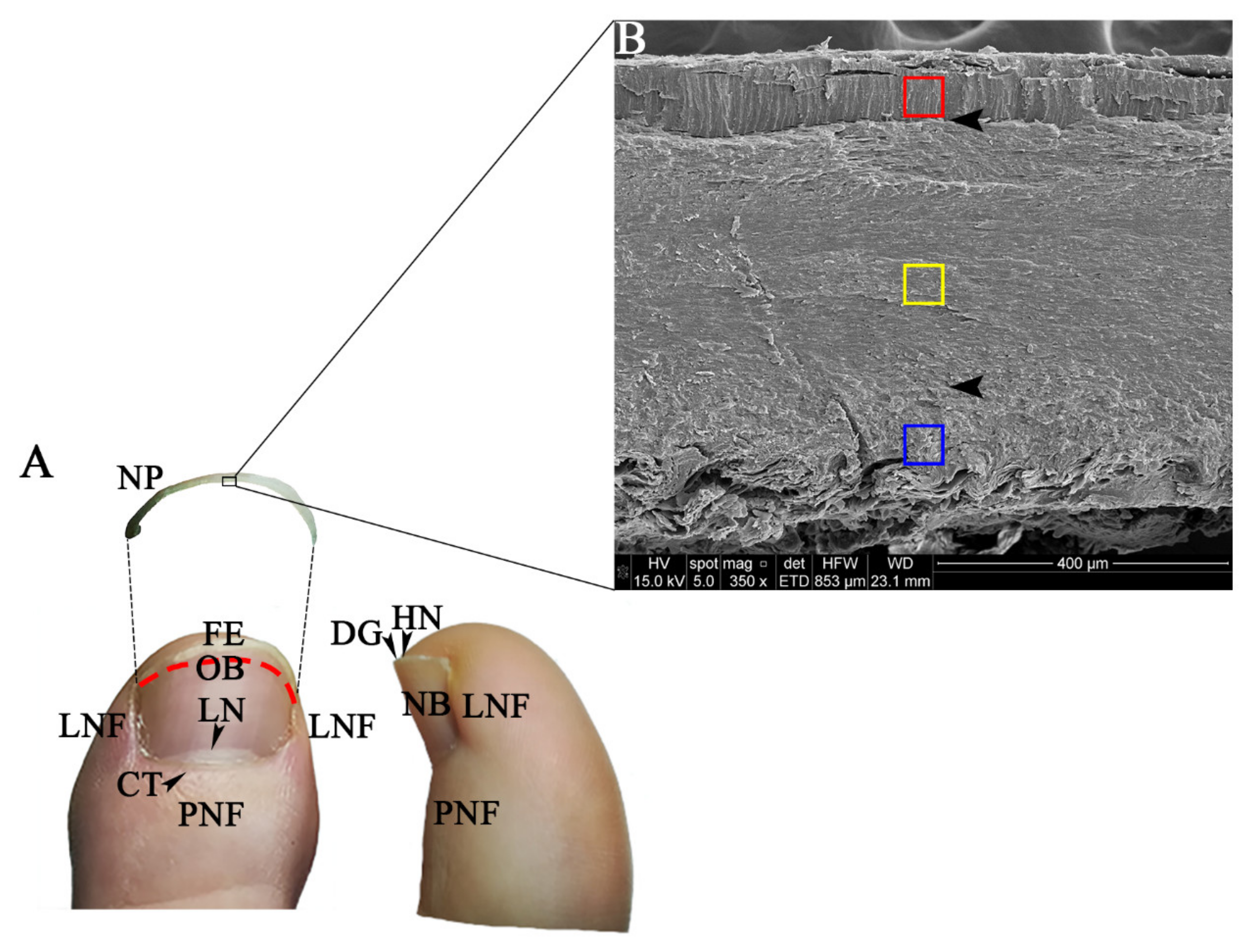 Fingernails - Ingrown fingernails - Dark Line - Fingernail Pain