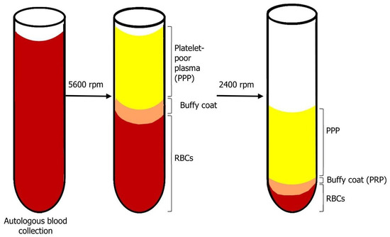 Biology Free Full Text Use Of Prp Prf And Cgf In Periodontal Regeneration And Facial Rejuvenation A Narrative Review