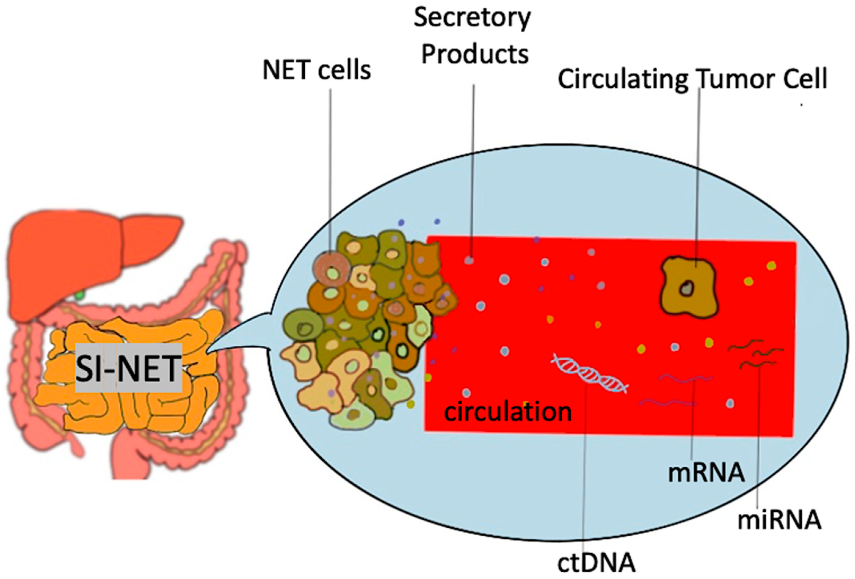 Biology Free FullText Biomarkers in Small Intestine NETs and