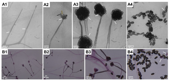 Update on Stachybotrys chartarum—Black Mold Perceived as Toxigenic and ...