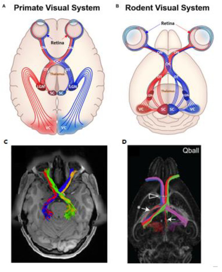 MR Safety: Respiratory Stimulators - Questions and Answers ​in MRI