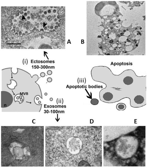 Extracellular Vesicles: Techniques and Biomedical