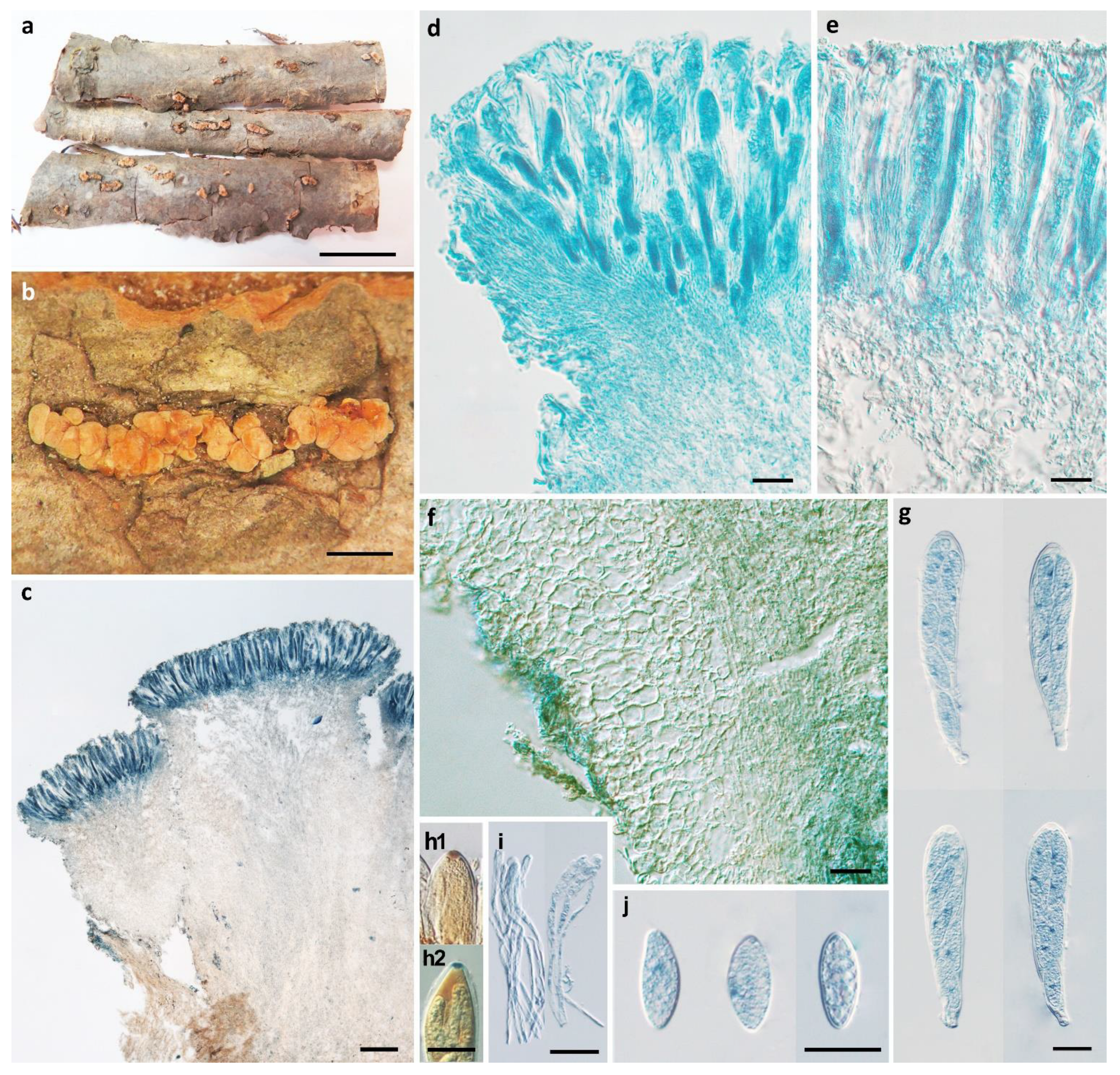 Additions to the Knowledge of the Genus Pezicula