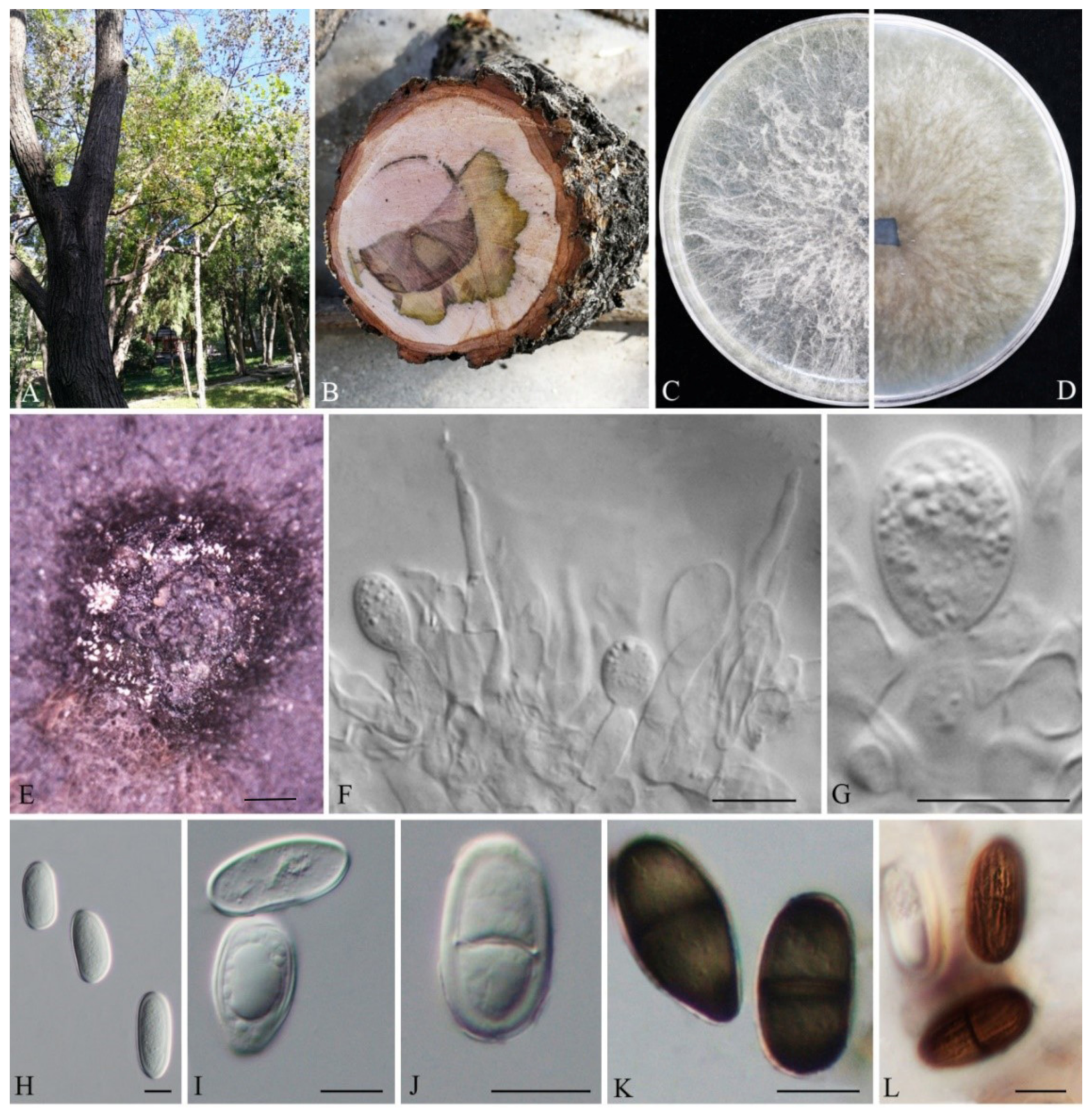Two Novel Lasiodiplodia Species from Blighted Stems of Acer