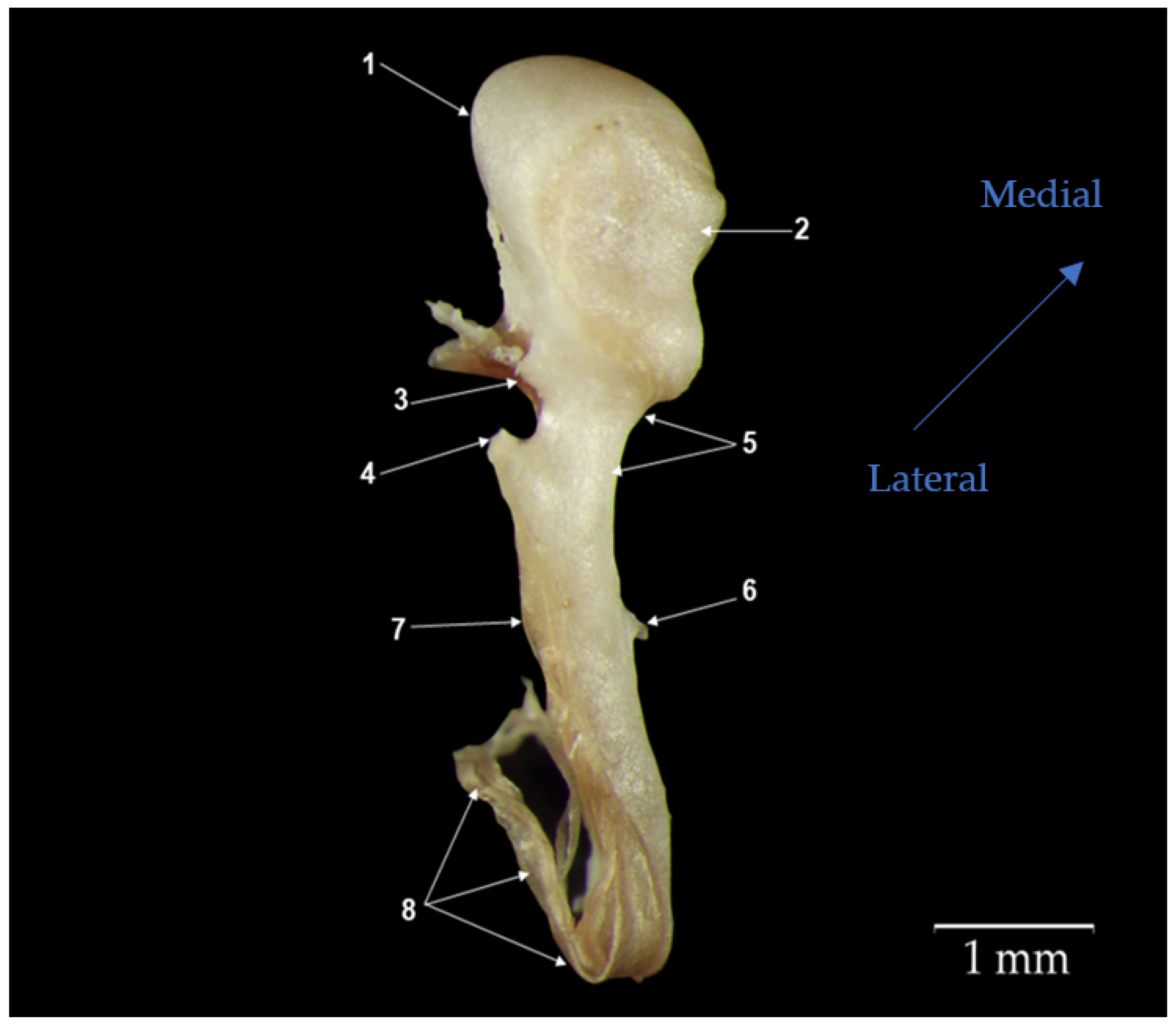 Characterization of Stapes Anatomy: Investigation of Human and