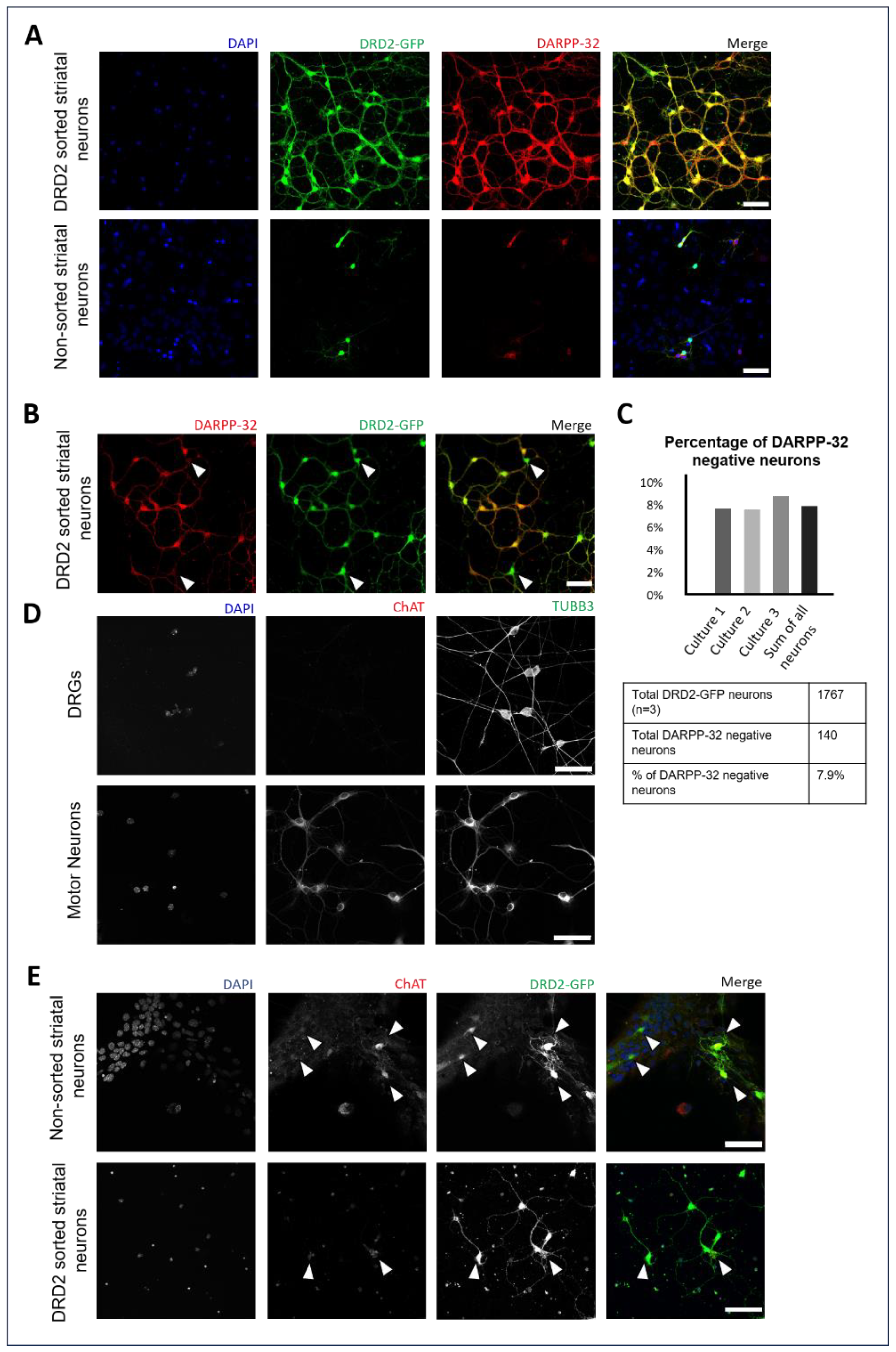 【Y u i 】 Dopaminergic Input Regulates the Sensitivity of Indirect