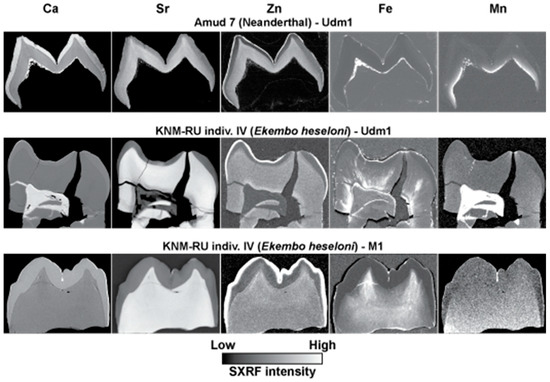 歯科 ZERO別冊 歯牙形態 Natural Tooth Morphology 歯科 ZERO別冊 歯牙形態 Natural Tooth Morphology