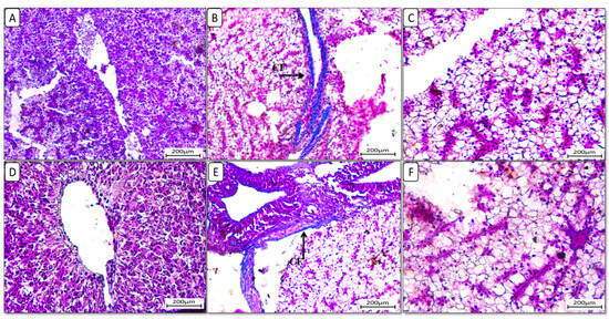 Dietary Chitosan Attenuates High-Fat Diet-Induced Oxidative