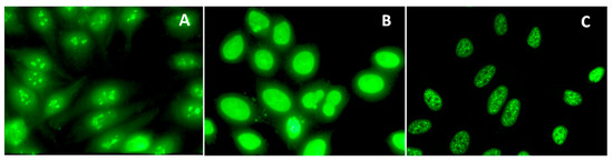 Exposure to Gold Induces Autoantibodies against Nuclear