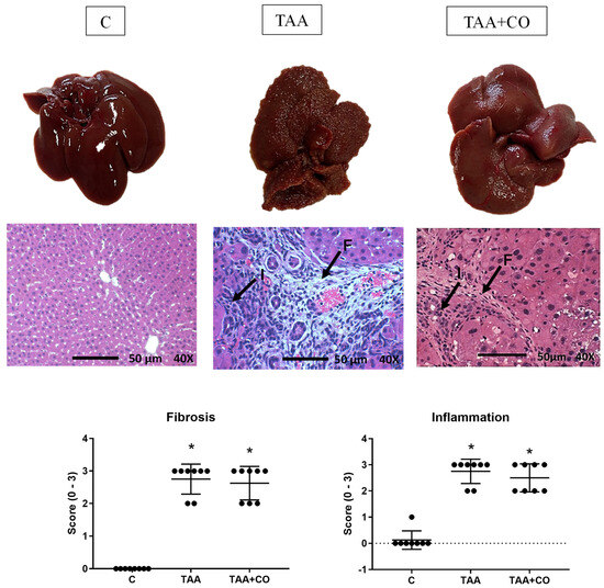 Waste(twice) - 専用 Copaiba Oleoresin Improves Weight Gain and IL-10